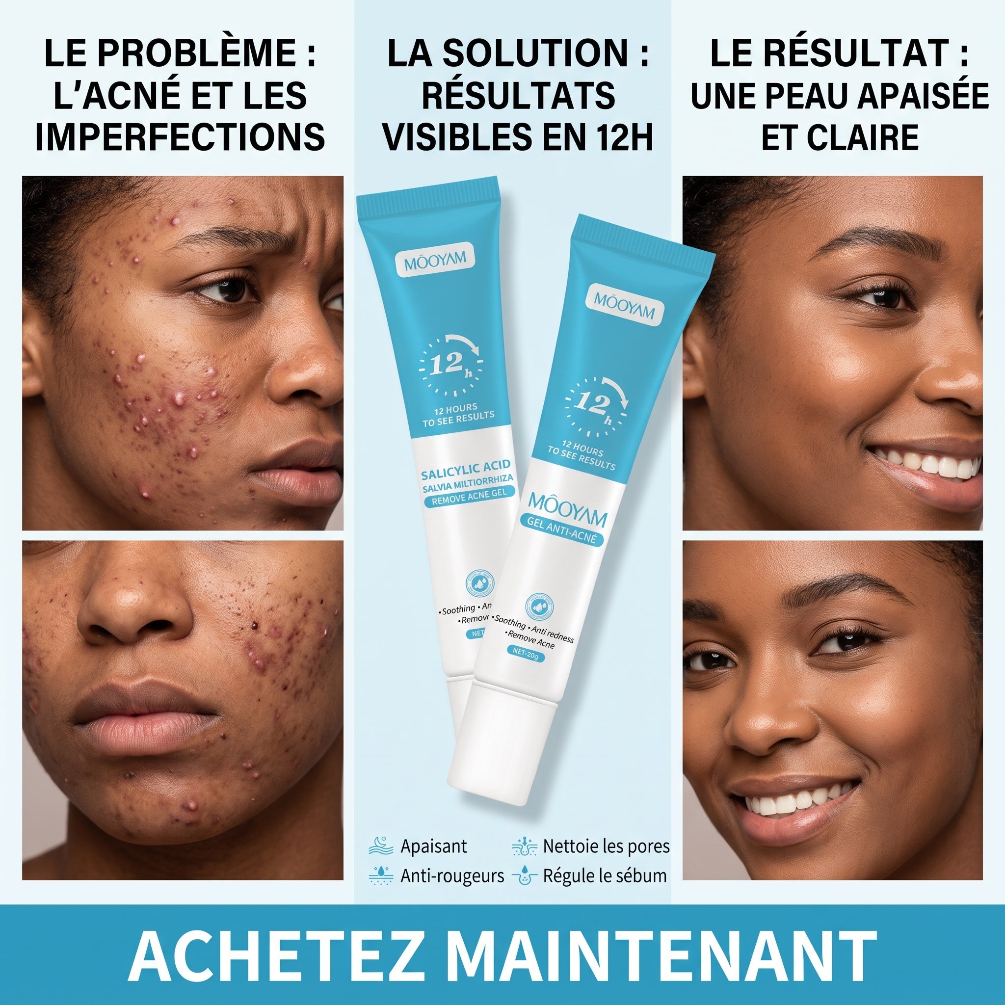 GEL ANTI-ACNÉ MOOYAM SALICYLIC ACID