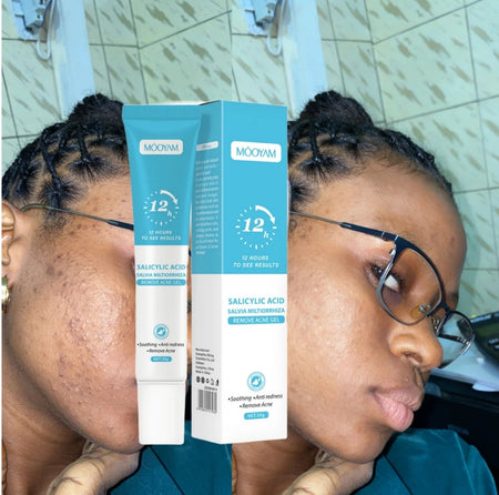 GEL ANTI-ACNÉ MOOYAM SALICYLIC ACID