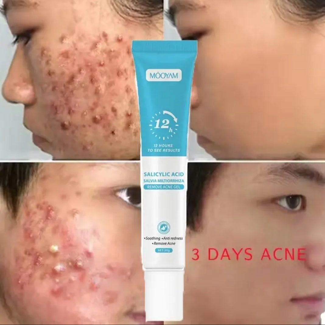 GEL ANTI-ACNÉ MOOYAM SALICYLIC ACID